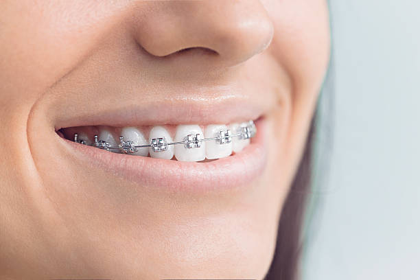 Best Wisdom Tooth Removal  in Versailles, OH